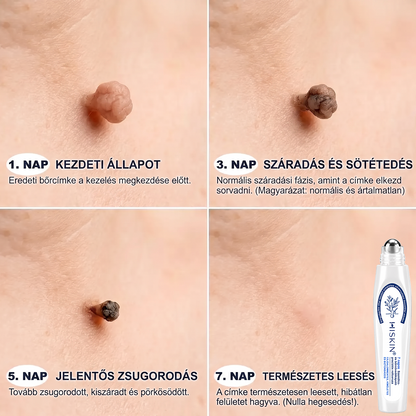 🔥 KÜLÖNLEGES UPGRADE AJÁNLAT! 🚢 Hiskin® 7 napos Szemölcseltávolító Roll‑on Ápoló Folyadék Fájdalommentes rollerball technológia, hegek nélkül! ✅ Extra 50% KEDVEZMÉNY CSAK MOST, ehhez a rendeléshez!