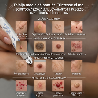 🔥 KÜLÖNLEGES UPGRADE AJÁNLAT! 🚢 Hiskin® 7 napos Szemölcseltávolító Roll‑on Ápoló Folyadék Fájdalommentes rollerball technológia, hegek nélkül! ✅ Extra 50% KEDVEZMÉNY CSAK MOST, ehhez a rendeléshez!